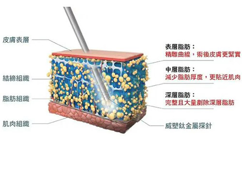 超塑吸脂和酷塑哪个好