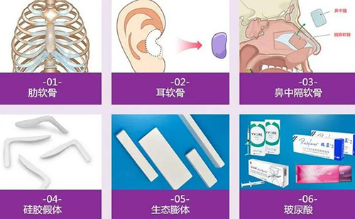 假体隆鼻用什么材料好