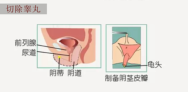 国内变性手术医院哪家好排名