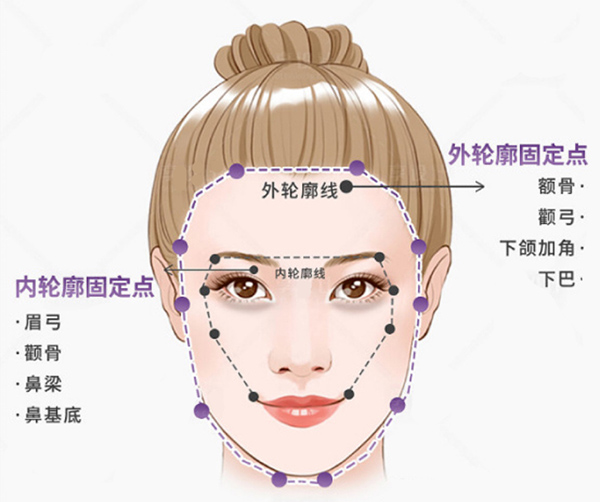 玻尿酸轮廓固定