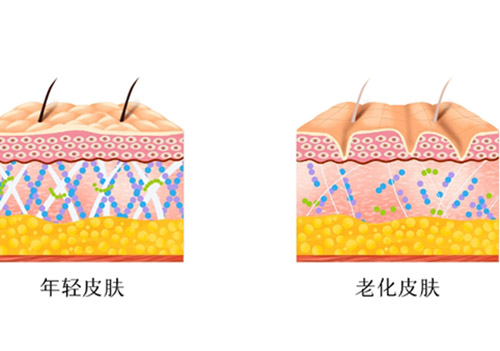 热玛吉四代和五代哪个效果好