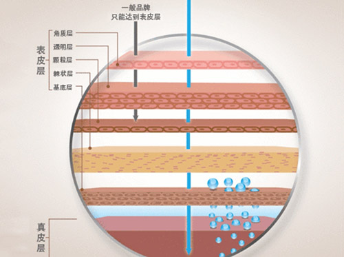 娃娃针的功效与作用是什么