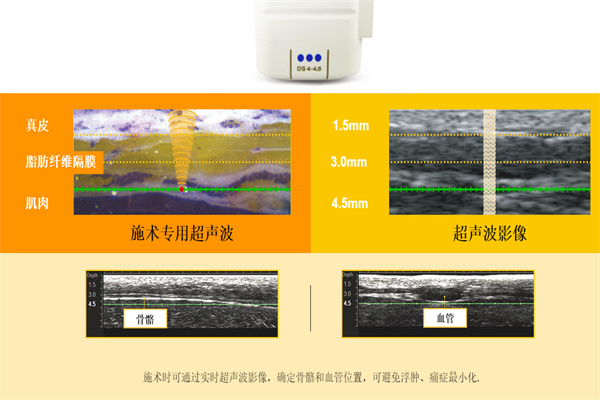 超声炮的工作原理