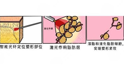 钻石超塑技术的注意事项是什么