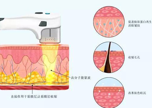 双逆博士面部抗衰作用和疗效