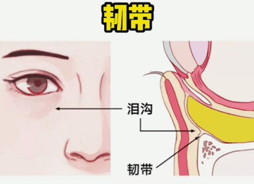 泪沟填充可以维持多久