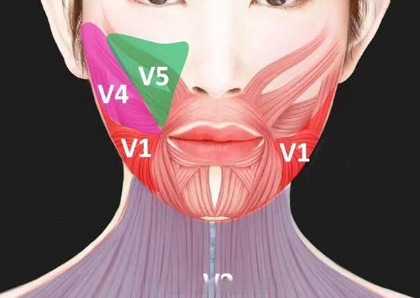 颈阔肌放松下颌缘提升点位图