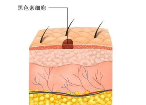 色素痣恶变的症状