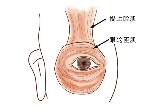 上睑提肌术