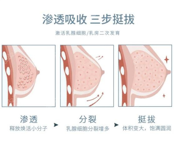 捷克水分子丰体针价格