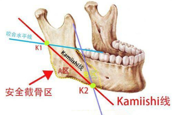 重庆华美潘宝华