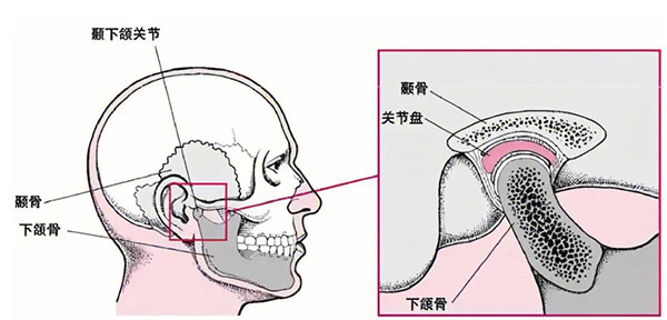 颞下颌关节紊乱