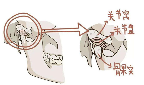 颞下颌关节紊乱