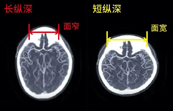 头包脸怎么填充好看