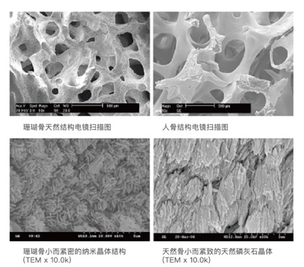 ​珊瑚骨隆鼻是什么材料