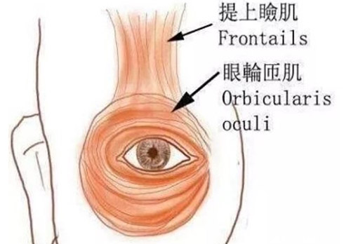 上睑下垂是什么原因造成的