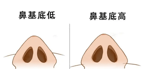 鼻基底高度