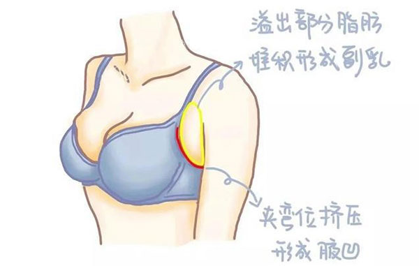 棒棒糖缩胸是什么意思