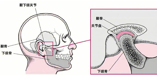 怎么确定下颌骨错位了