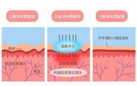 酒泉市人民医院皮肤科袁艳丽怎么样？医生简介+皮肤病治疗