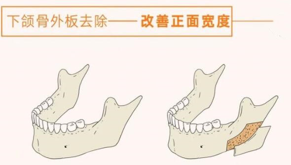 QQ截图20220106110043.jpg