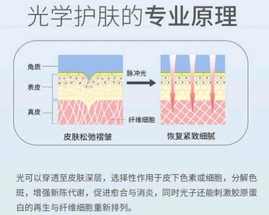 镭射净肤和光子嫩肤有什么区别?哪个好？