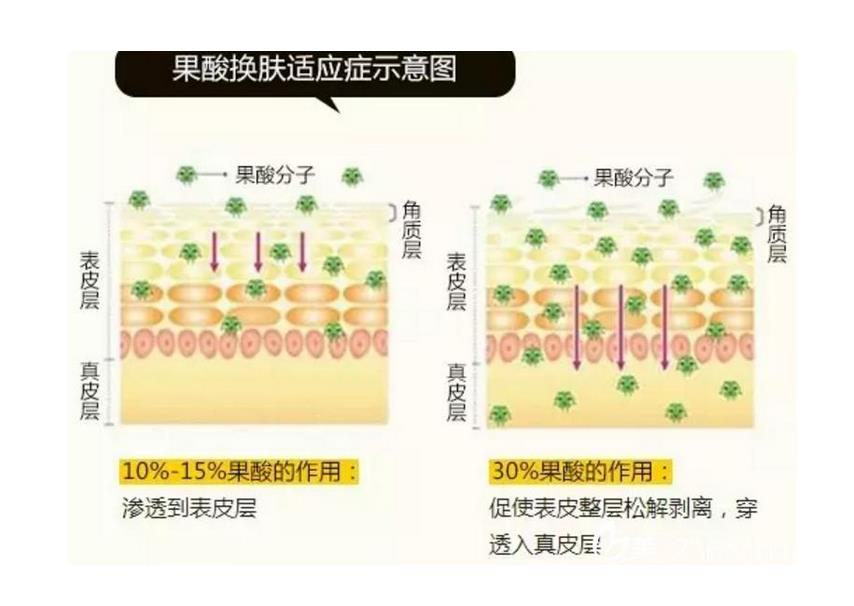 果酸2.jpg