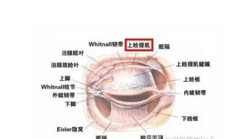 怎么促进提上睑肌手术的修复