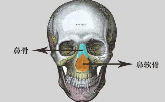 鼻骨矫正有哪些方法?