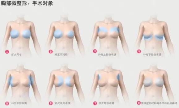 乳房缩小手术安好吗？乳房缩小手术的成果好不好?