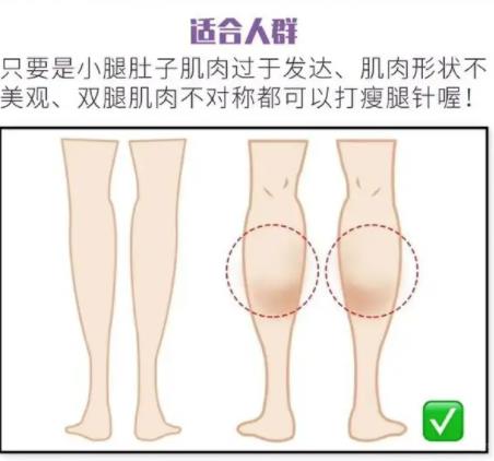 跳绳小腿会长肌肉吗？跳绳腿变粗了怎么办?