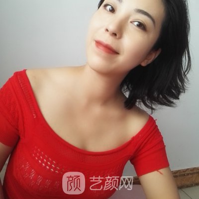 西安叶子朱健康医生隆胸实例出炉｜附前后对比成果图