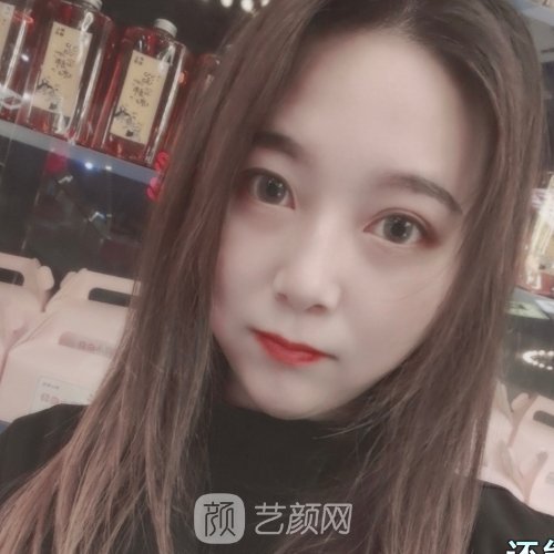 福州格莱美周秀峰做鼻子怎么样？全新体验实例出炉