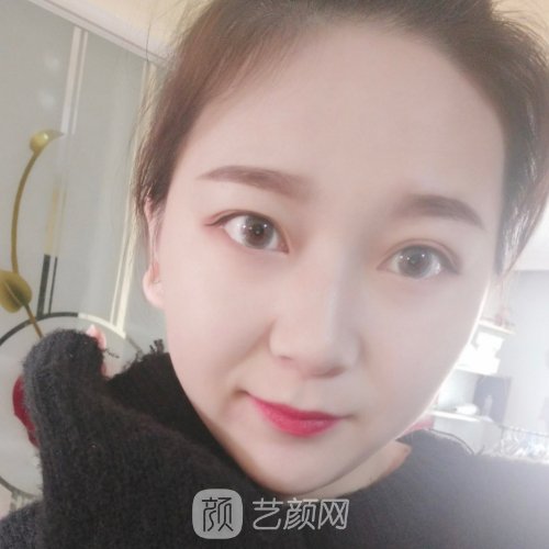 福州格莱美周秀峰做鼻子怎么样？全新体验实例出炉