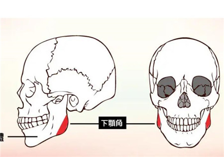 下颌角肥大有哪些手术方法