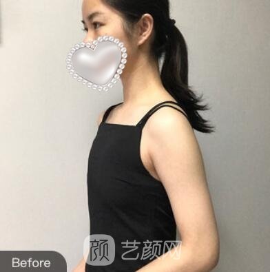 王先松美容医生怎么样？医生个人简介+乳房整形实例图片