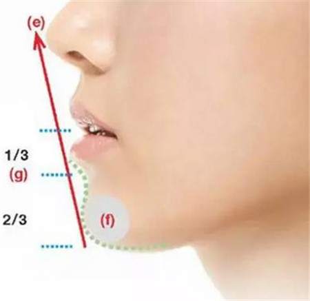 下巴后缩有哪些类型?下巴前移治疗有哪些方法?