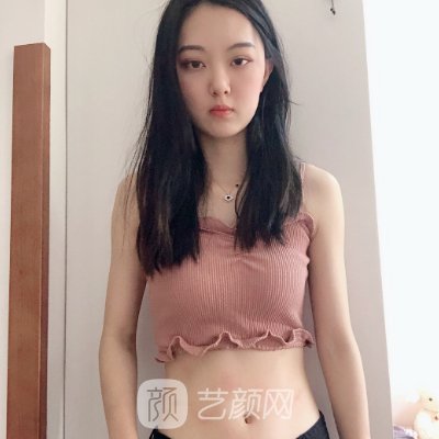 长春子田整形医院吸脂靠谱吗？医院招牌实例出炉