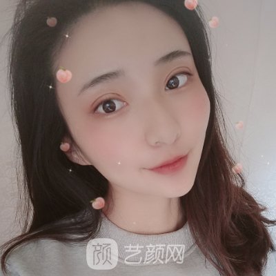 杭州新清吟医院眼综合贵吗?全新收费标准及实例一览