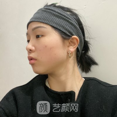 淄博天丽医美整形医院怎么样？2022嫩肤除皱实例一览