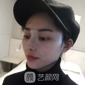 黄在弘做鼻子怎么样？医生简介+隆鼻实例更新