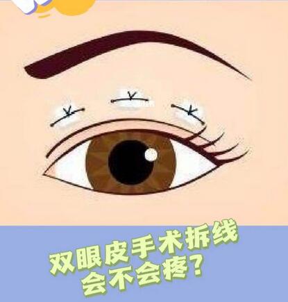 有多少割双眼皮的方法？