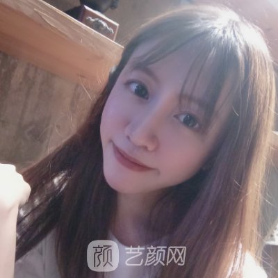 盐城美辰医疗美容诊所正规吗？乔雅登面部填充实例出炉