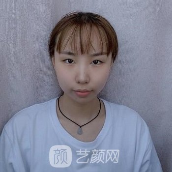 呼和浩特闫小林美容院现在还是闫小林主刀吗？医生简介+真人实例