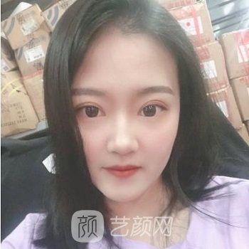 芭比眼综合图片前后对比，变成人间水蜜桃，如此简单