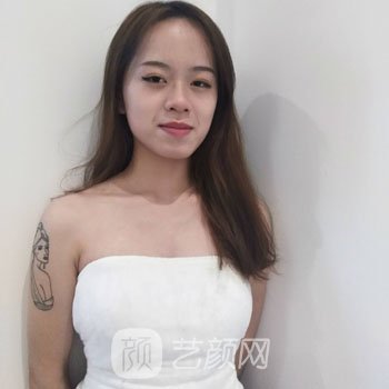 华美宋晓东隆胸失败修复实例，术后变得更加自信有魅力