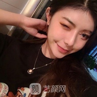 嘉兴莱森医疗美容门诊部正规吗?医院招牌头发加密实例出炉