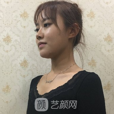 北京华韩整形医院正规吗?医院隆胸实例公布