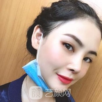 罗勇隆鼻经典实例，重塑精致鼻部形态，整个人都是美美的