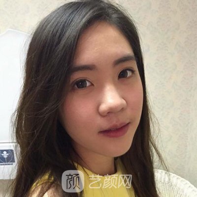 潮州韩美整形医院除皱美白实例发布|成果自然美观